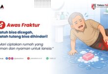 Photo of Yakes Telkom-Mengenal Fraktur & Pencegahannya